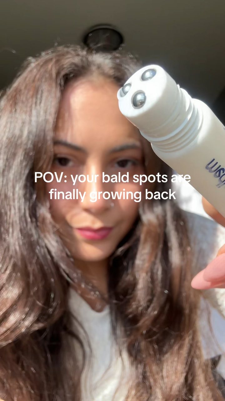 Scalp Serum: Before and After